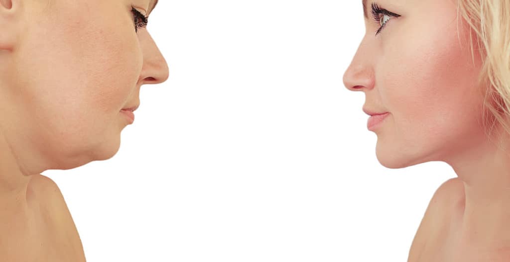 Two women facing one another