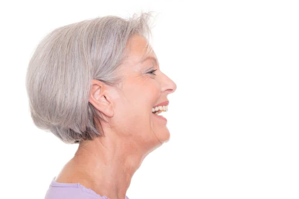 rf microneedling treatment cocoa fl, RF MICRONEEDLING